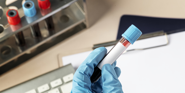 Resultado positivo em exame de DNA basta para concessão de pensão por morte